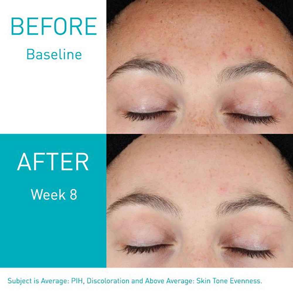 CeraVe Serum Con Retinol Acné y Rejuvenecimiento - Imagen 3